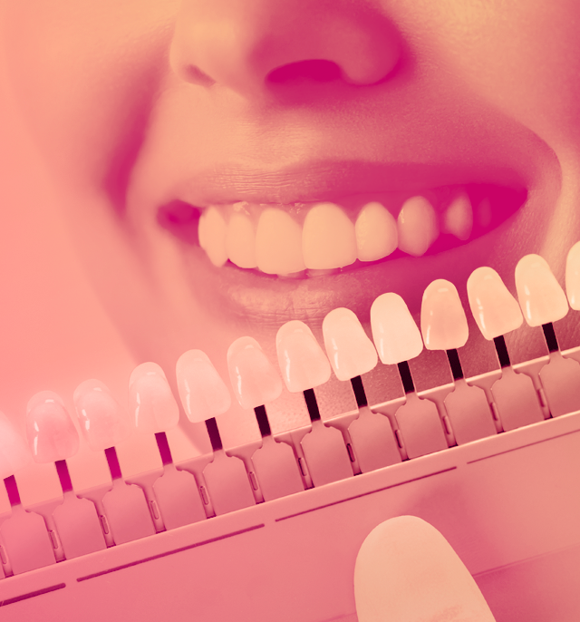 Imersão em Laminados Cerâmicos - Lote 1