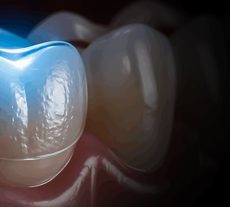 Aperfeiçoamento Dentistica Restauradora