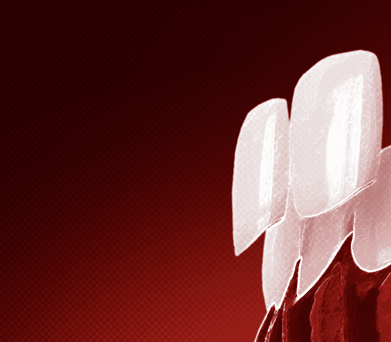 Imersão em Resina Composta em Dentes Anteriores - 10x